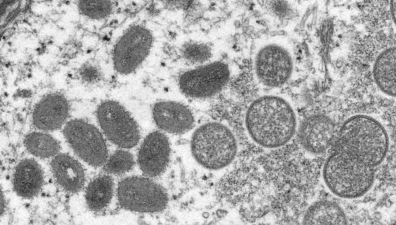 Varíola do Macaco: Ministério da Saúde confirma 696 casos