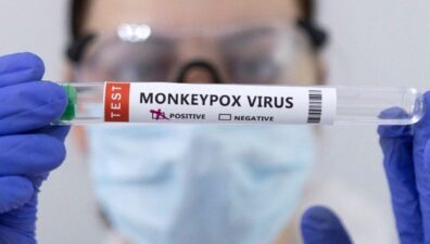 Após Brasil, Espanha tem primeira morte de paciente com varíola do macaco