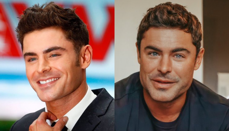 Zac Efron conta que fratura na mandíbula provocou mudança em seu rosto