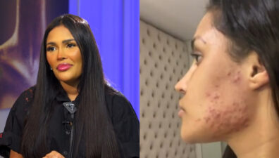 Flay diz que ganhou 10 kg e espinhas com 'chip da beleza': 'Foi o chip da feiura'