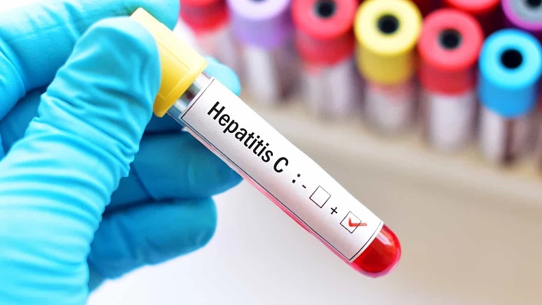 Fiocruz assina acordo para produzir medicamento para hepatite C