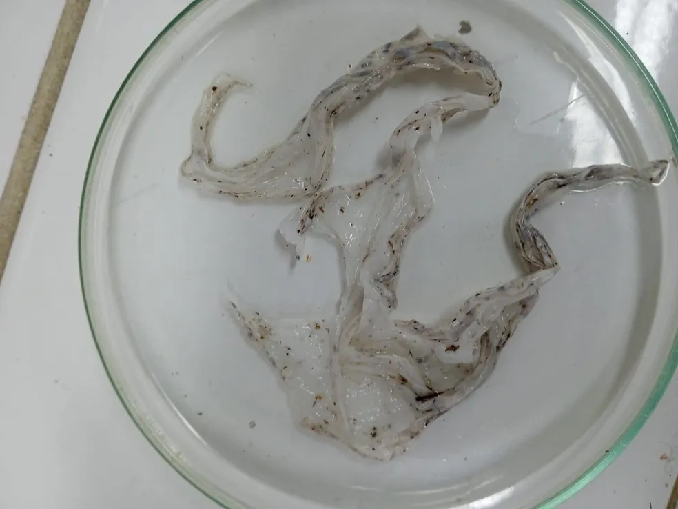 Estudo encontra plástico no intestino de 6 espécies de peixes no Amazonas