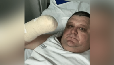 Humorista tem mão amputada após acidente com fogos de artifício em SC